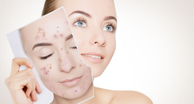 Elimina las manchas de tu cara con un tratamiento facial adecuado